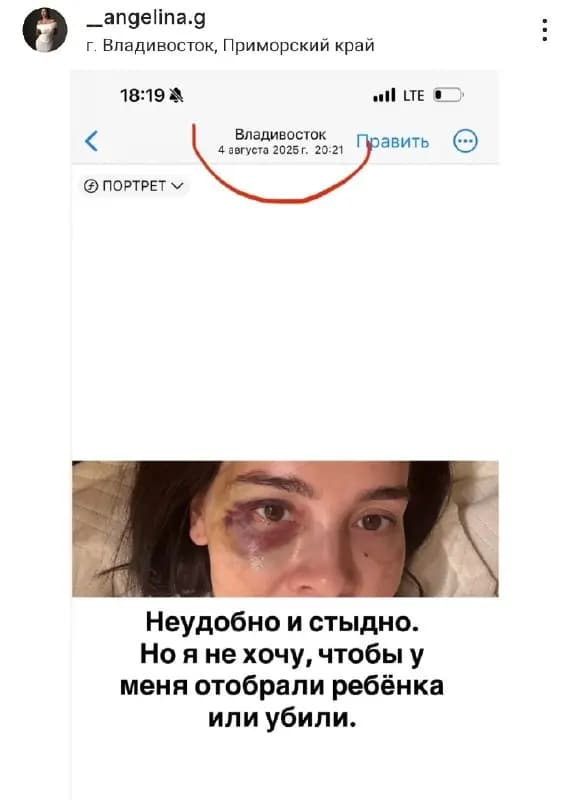 Жительница Владивостока пожаловалась на избиения мужа и бездействие полиции — фото 1