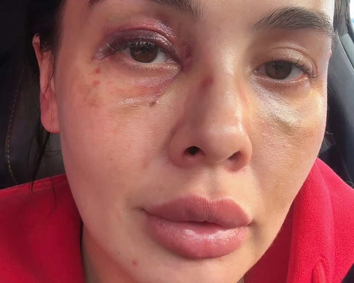 Полиция опровергла бездействие по факту травмирования жительницы Владивостока