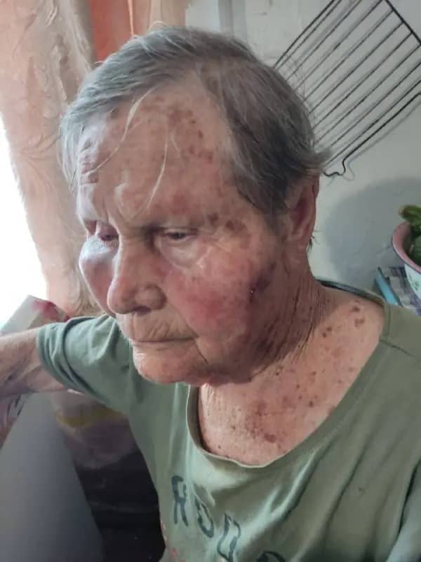 В Артёме родственники заявили об избиении вдовы ветерана Великой Отечественной войны