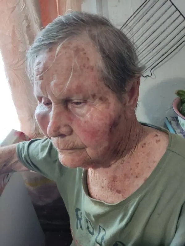 В Артёме родственники заявили об избиении вдовы ветерана Великой Отечественной войны